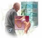 Новые рекомендации касательно остеопороза у мужчин