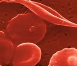 Средство против анемии стимулирует раковые клетки