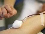 Повышенный уровень глюкозы крови в сочетание с циррозом способствует развитию рака печени