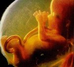 Судьба «запасных» эмбрионов неясна