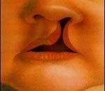 «Заячья губа» у ребенка – результат курения мамы