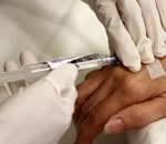 Ученые придумали новый способ уморить опухоль голодом