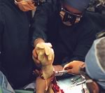 Французские хирурги пересадили мужчине лицо и руки