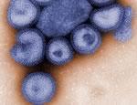Свиной грипп инфицирует клетки глубоко в легких