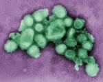 У жертв вируса H1N1 легкие оказались полностью поражены
