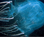 Австралийская девочка чудом выжила после укуса смертельно ядовитой медузы