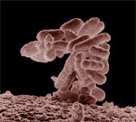 Появление штаммов опасных бактерий, устойчивых к лекарствам – обратная сторона гуманизма