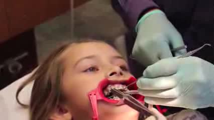 Видео для детей: установка зубной брекет-системы – это совсем не больно