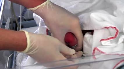 Как берут у новорожденных кровь для анализа на состав газов