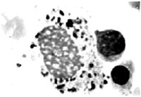 Нормальный макрофаг