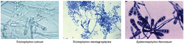 Trichophyton rubrum, Trichophyton mentagrophytes, Epidermophyton floccosum